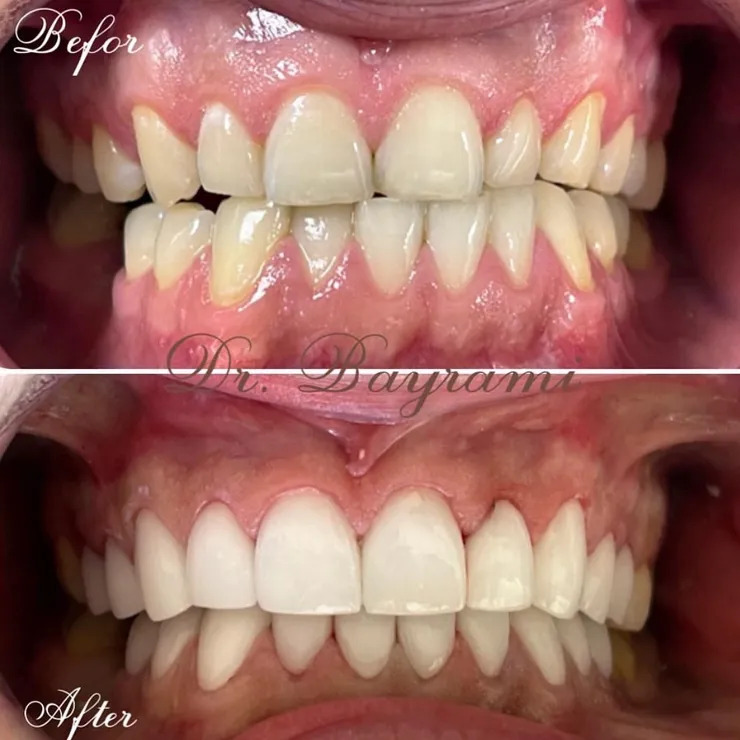 All Procedures Before & After Image