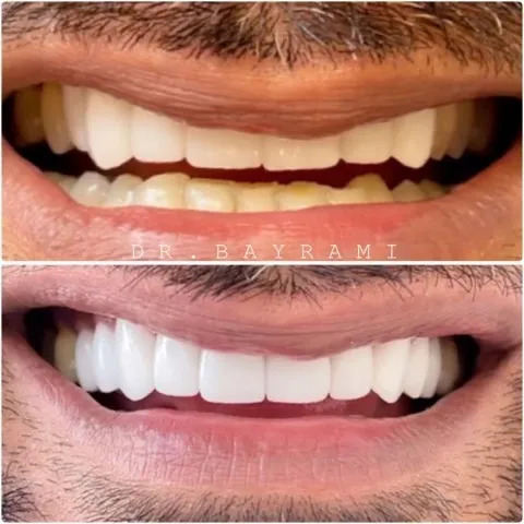 All Procedures Before & After Image