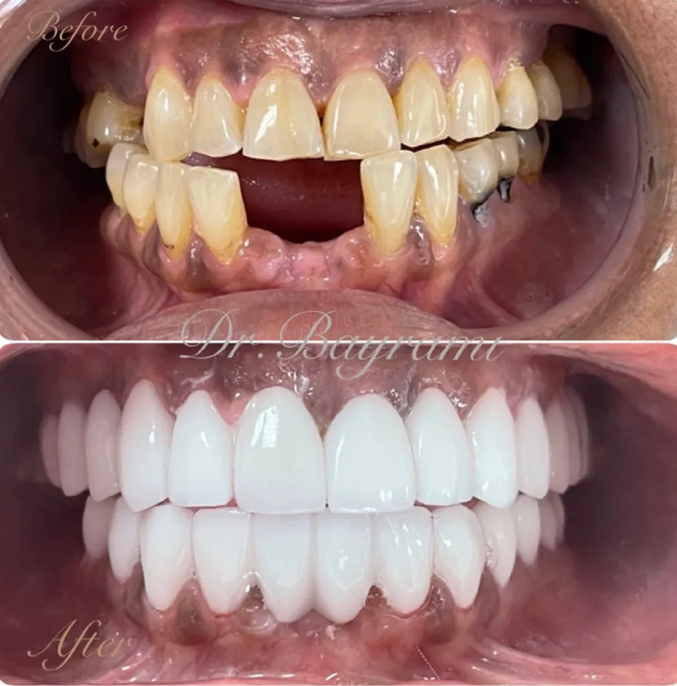 All Procedures Before & After Image