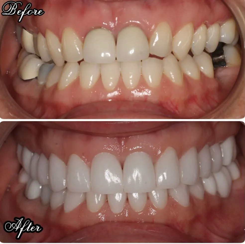 All Procedures Before & After Image