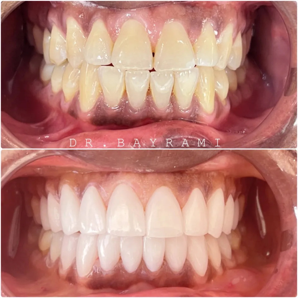 All Procedures Before & After Image